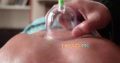 Hijama cure Cervical Pain Stiff Muscles Anxiety,Allergies Hair,Skin Problems