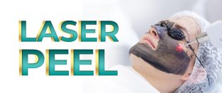 Laser Carbon Peel Treatment in Islamabad – Rehman Medical Center