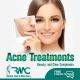 Laser Treatment For Acnes cars in Islamabad – Acnes cars Removal | RMC