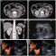 Toshiba Asteion Multi 4 Slice Ct Scan 2023 Deal Just In Pkr 11 Million