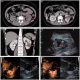 Toshiba Asteion Multi 4 Slice Ct Scan 2023 Deal Just In Pkr 11 Million