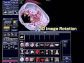 Toshiba Asteion Multi 4 Slice Ct Scan 2023 Deal Just In Pkr 11 Million
