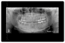 Planmeca Proline XC Panoramic X Ray ( DR OPG ).