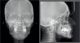 Planmeca Proline XC Panoramic X Ray ( DR OPG ).