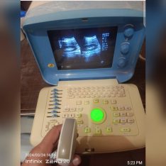Portable ultrasound machine for sale